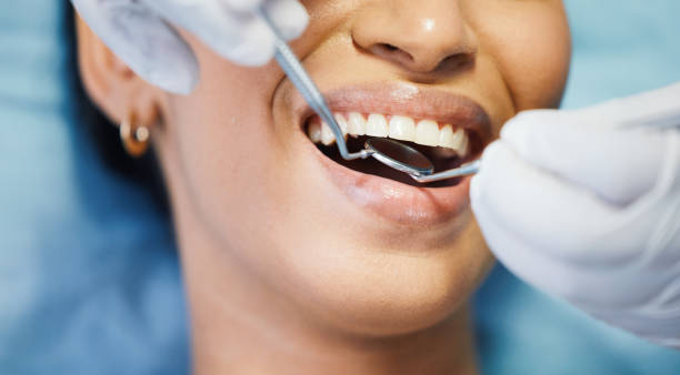 Oral Surgery in Homer Glen, IL